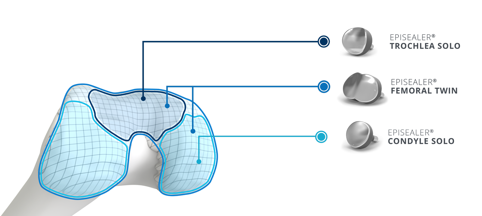 Self Photos / Files - Episealer-Knee-Implant
