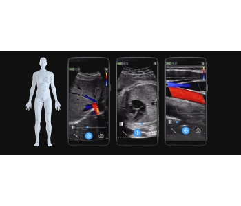 Vscan Air handheld Ultrasound Hong Kong 3