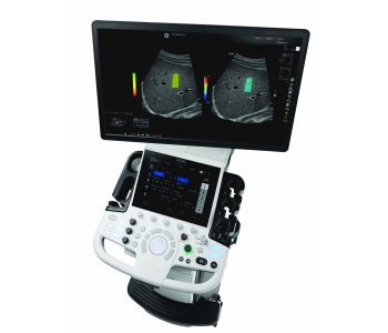 LOGIQ P10 general imaging ultrasound