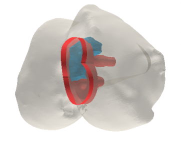 Self Photos / Files - 3D implant visualization